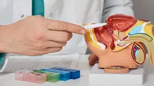 Los casos de cáncer de próstata se duplicarán para 2040 Modelo anatómico del sistema reproductor masculino