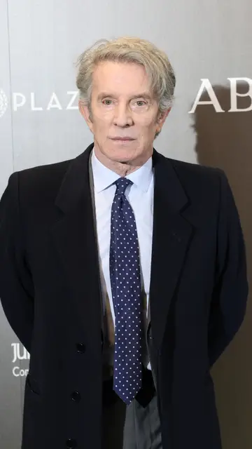 Alfonso Díez sorprende con su nuevo rostro Alfonso Díez sorprende con su nuevo rostro