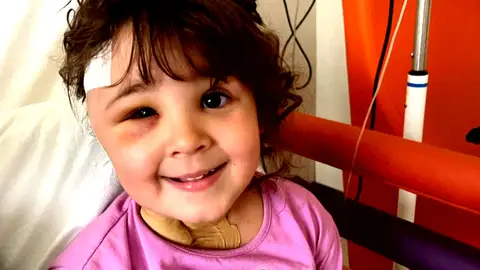 Extraen una aguja del cerebro tras una cita en el dentista a una niña de 4 años: "Mi hija ha nacido otra vez" Extraen una aguja del cerebro tras una cita en el dentista a una niña de 4 años: "Mi hija ha nacido otra vez"