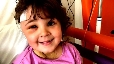 Extraen una aguja del cerebro tras una cita en el dentista a una niña de 4 años: 