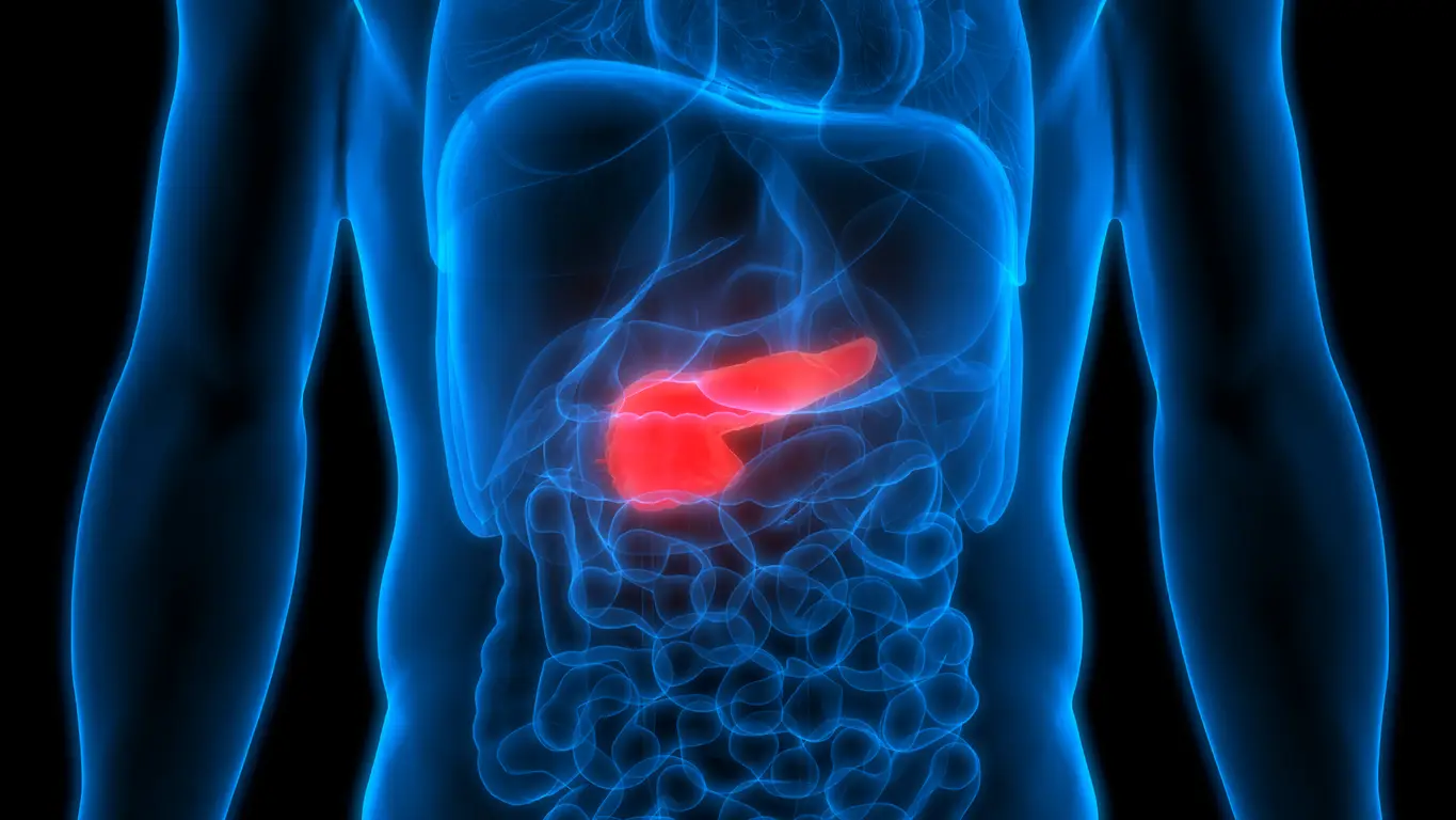Pancreatitis aguda Pancreatitis aguda