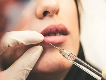 Bótox en los labios Bótox en los labios