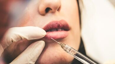 ¿Cómo afectan los retoques estéticos y el bótox en nuestra salud mental?