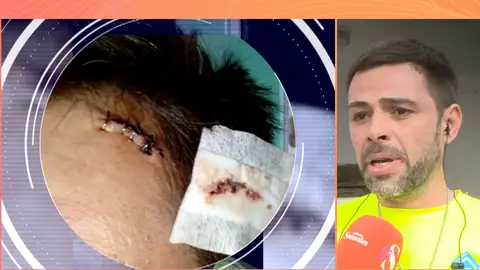 Miguel pidió a sus vecinos que hicieran menos ruido y respondieron a golpes: "Estuve 30 minutos inconsciente" Miguel pidió a sus vecinos que hicieran menos ruido y respondieron a golpes: "Estuve 30 minutos inconsciente"