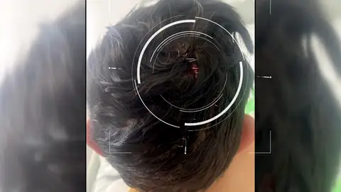 Brutal ataque de un mastín de 60 kilos a un niño de 5 años: "Llevamos años de conflicto, vivimos con miedo" Brutal ataque de un mastín de 60 kilos a un niño de 5 años: "Llevamos años de conflicto, vivimos con miedo"