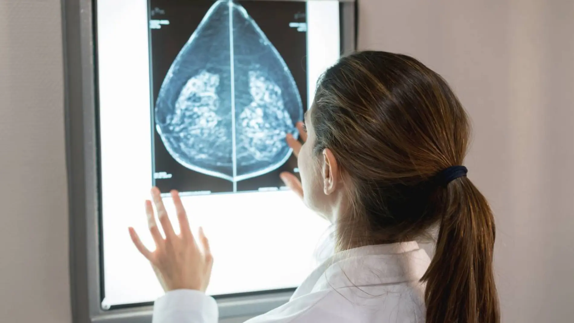 cáncer de mama, diagnóstico cáncer de mama, diagnóstico
