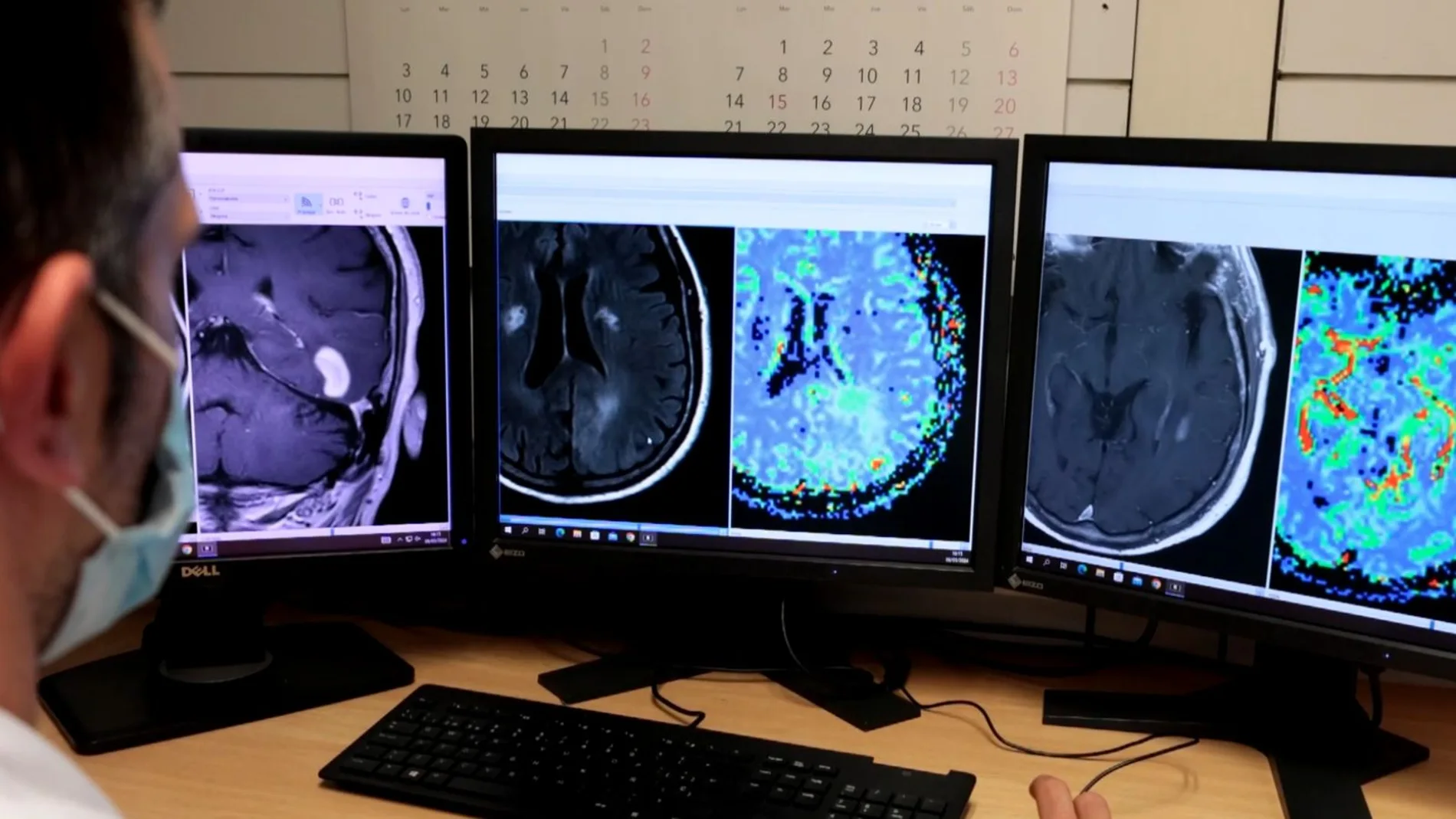 Imágenes de resonancia magnética de cerebro Imágenes de resonancia magnética de cerebro
