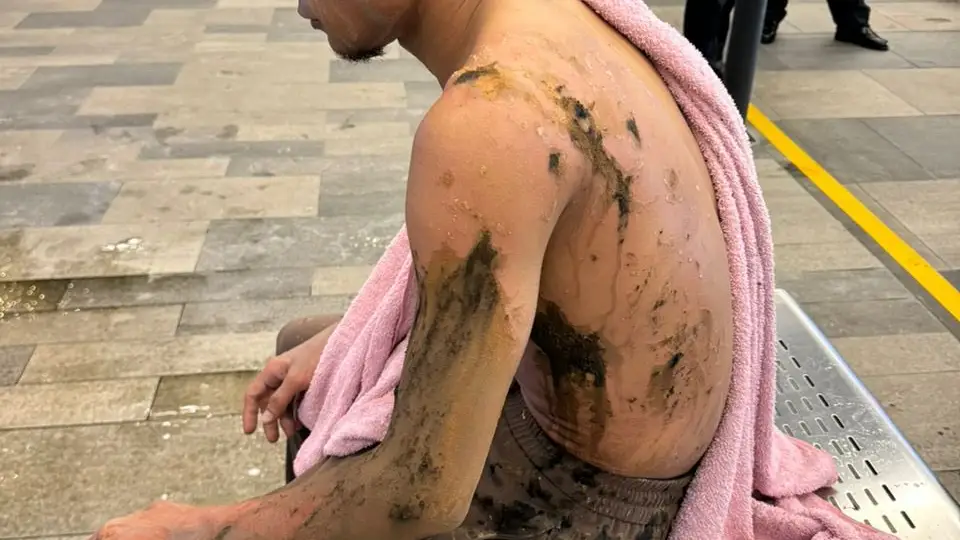 El jugador Faisal Halim tras sufrir el ataque El jugador Faisal Halim tras sufrir el ataque