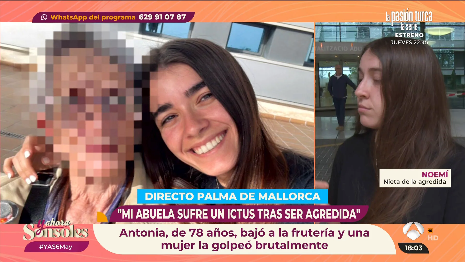 Antonia, de 78 años, en estado grave tras una agresión sin motivos: "La agresora se fue tan pancha a su casa" Antonia, de 78 años, en estado grave tras una agresión sin motivos: "La agresora se fue tan pancha a su casa"