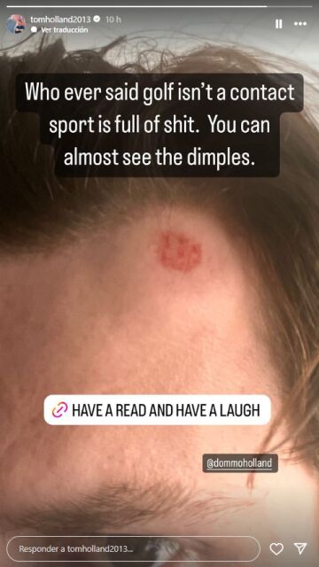 La herida de Tom Holland