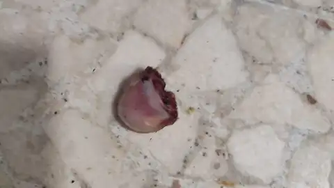 El dedo olvidado en un bar El dedo olvidado en un bar