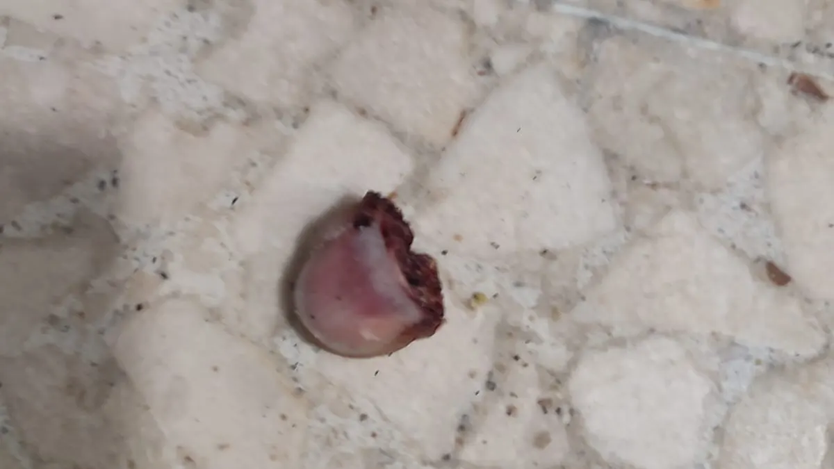 El dedo olvidado en un bar El dedo olvidado en un bar