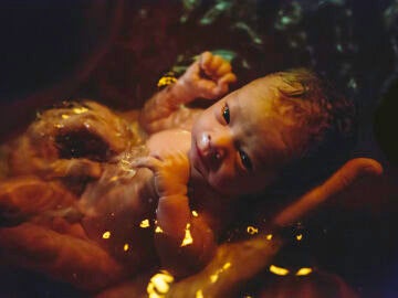 Bebé que nace en el agua