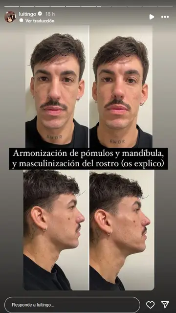 Story Luitingo Story Luitingo