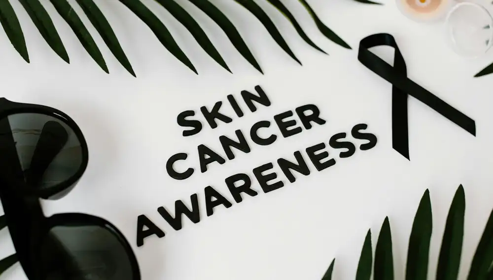 La protección solar es vital para prevenir el cáncer de piel.