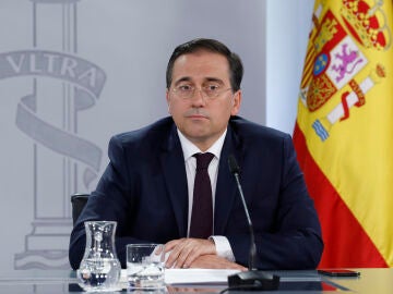 José Manuel Albares