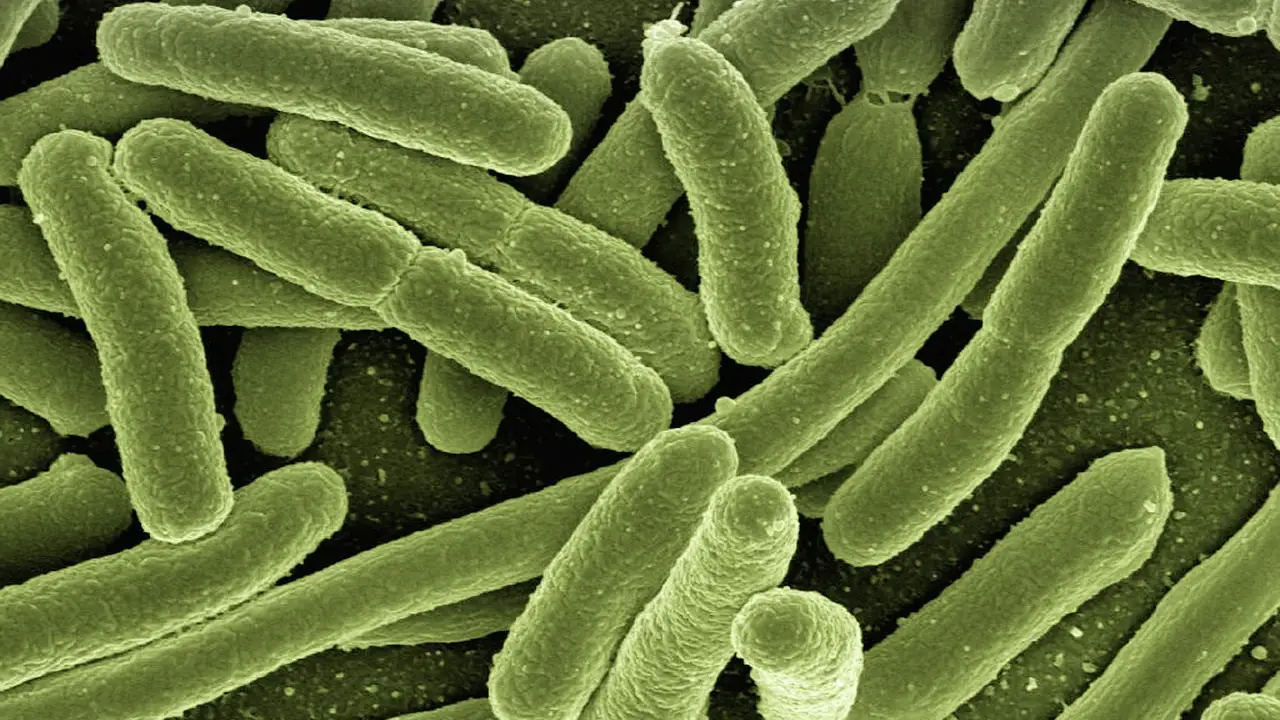 E. coli E. coli