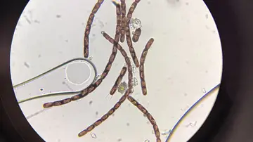 Algunos microorganismos de Groenlandia Algunos microorganismos de Groenlandia