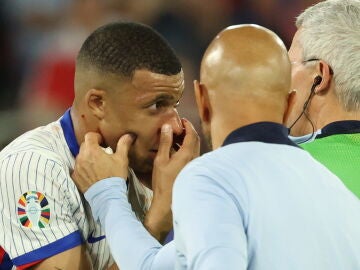 Kylian Mbappé es atendido por los servicios médicos tras fracturarse la nariz