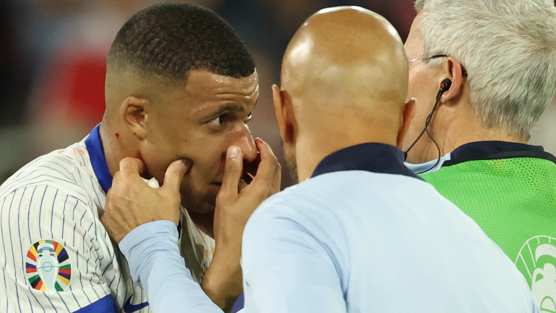 Kylian Mbappé es atendido por los servicios médicos tras fracturarse la nariz Kylian Mbappé es atendido por los servicios médicos tras fracturarse la nariz