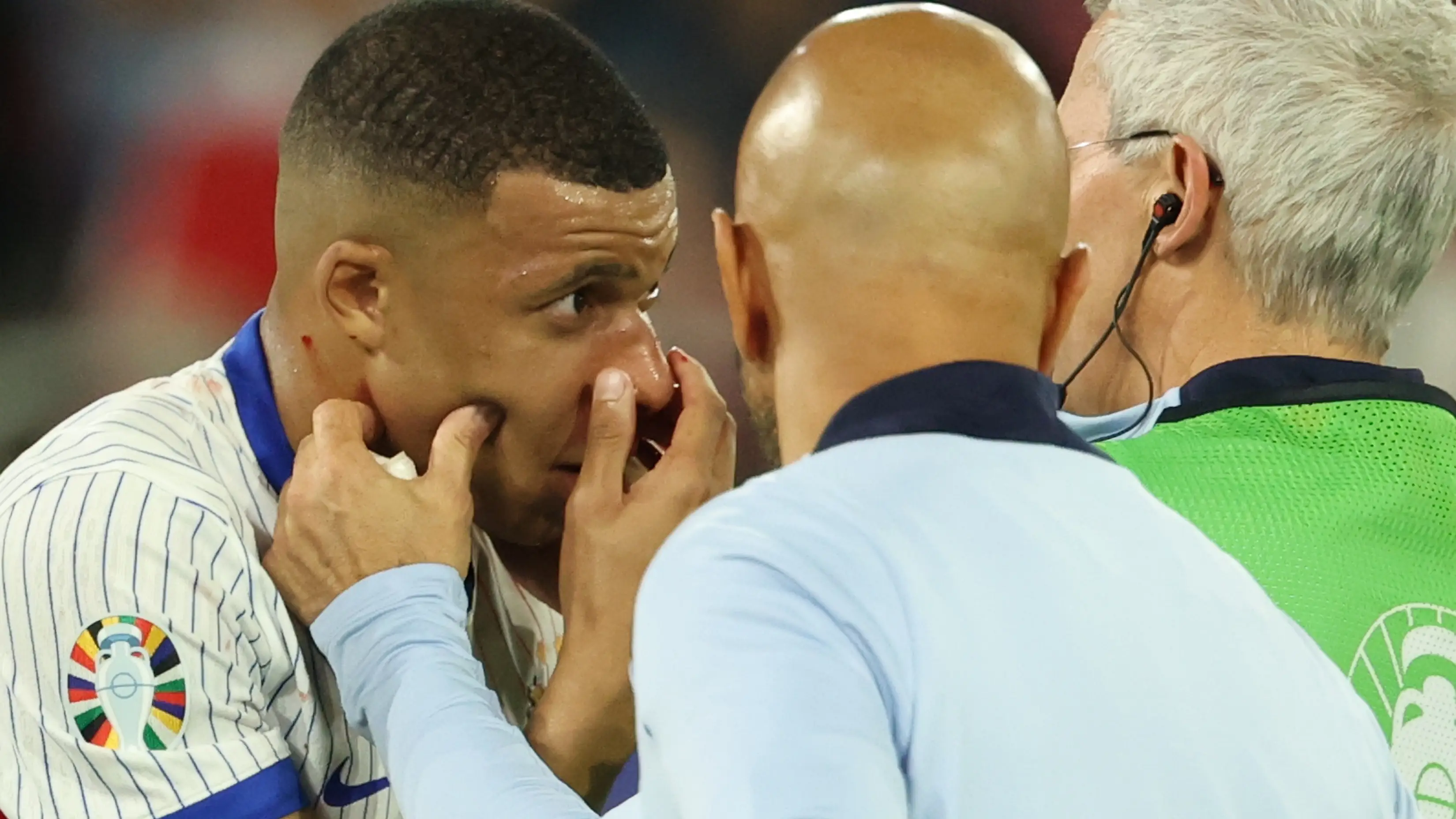 Kylian Mbappé es atendido por los servicios médicos tras fracturarse la nariz Kylian Mbappé es atendido por los servicios médicos tras fracturarse la nariz