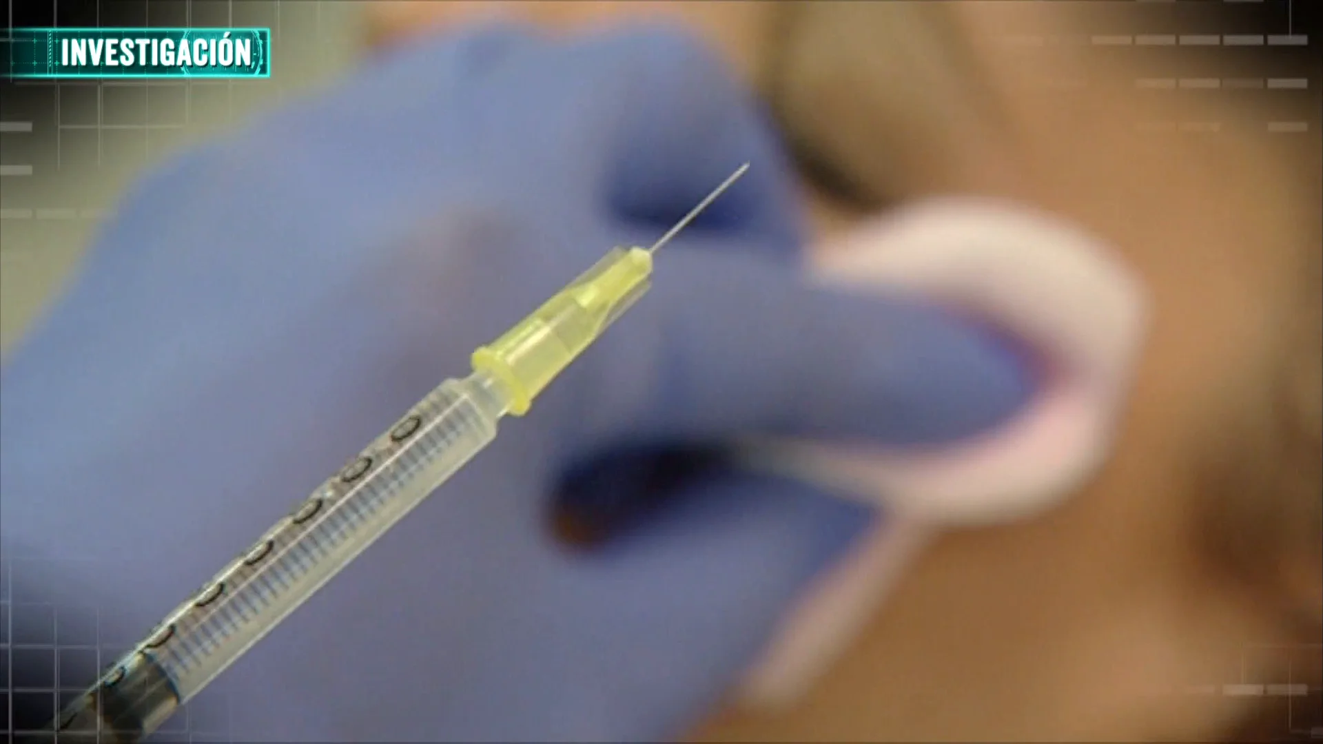 La peligrosa moda de suministrar Botox clandestino en casa: ¿Hasta dónde puede llevar el miedo a envejecer? La peligrosa moda de suministrar Botox clandestino en casa: ¿Hasta dónde puede llevar el miedo a envejecer?