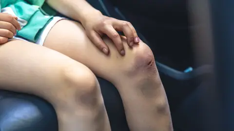 Herida en la rodilla