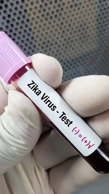Test del virus Zika Test del virus Zika
