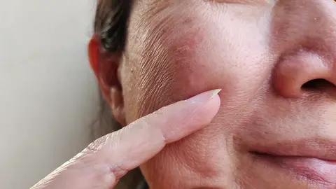 Mujer con piel seca Mujer con piel seca