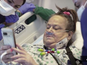 Lisa Pisano, la segunda persona en el mundo en recibir un trasplante de riñón de cerdo