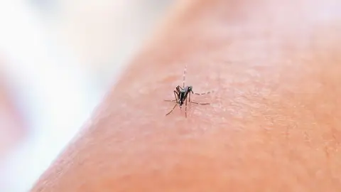 Mosquito en la piel Mosquito en la piel