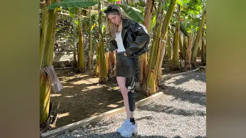 Marta Casado, la superhéroe que volvió a andar con una pierna biónica Marta Casado, la superhéroe que volvió a andar con una pierna biónica