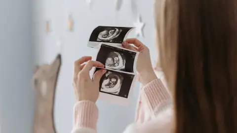 Ecografía Ecografía