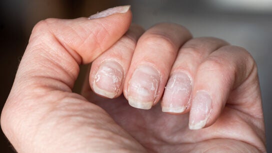 Primer plano de u&ntilde;as quebradizas