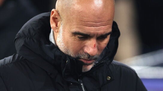 Pep Guardiola, con un corte en la nariz anoche en el Etihad Stadium