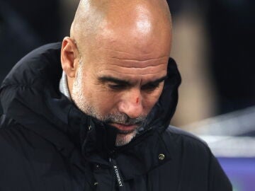 Pep Guardiola, con un corte en la nariz anoche en el Etihad Stadium