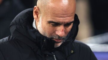 Pep Guardiola, con un corte en la nariz anoche en el Etihad Stadium