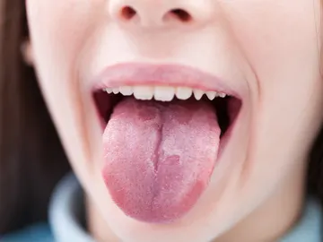 Lengua geográfica Lengua geográfica