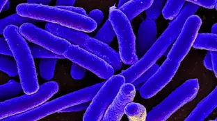 Escherichia coli Escherichia coli