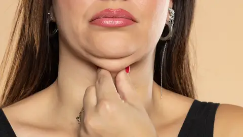 Papada de una mujer Papada de una mujer