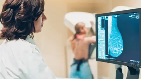 Cáncer de mama Cáncer de mama