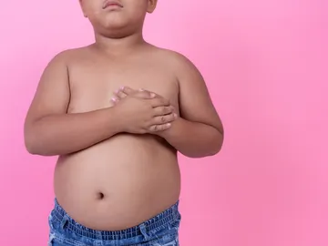 Niño con sobrepeso Niño con sobrepeso