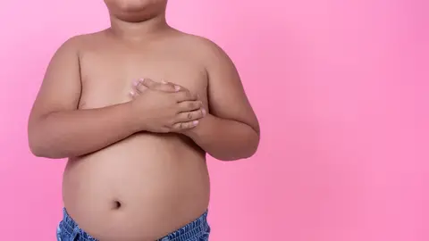 Niño con sobrepeso Niño con sobrepeso