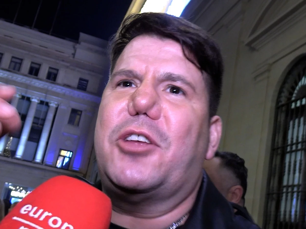 Lucas, de Andy y Lucas, zanja la polémica por el aspecto de su nariz: "He sido feo, soy feo y seré feo"