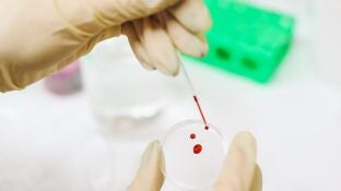 Imagen de archivo de una muestra de sangre y ADN