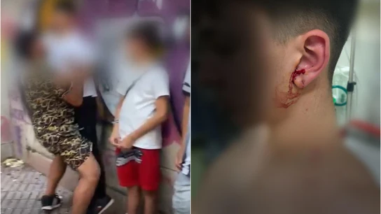 Imagen de la agresión a tres menores en Vigo Imagen de la agresión a tres menores en Vigo