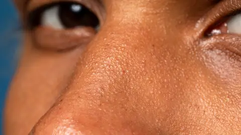 Poros de la cara Poros de la cara