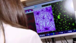 El autismo camina hacia una posible curaci&oacute;n