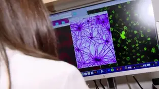 Análisis del autismo El autismo camina hacia una posible curación