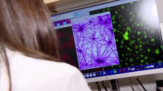 El autismo camina hacia una posible curaci&oacute;n